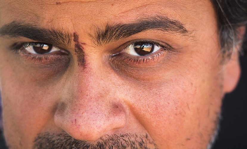 Close-up of Arash Afshar headshot with a scratch on his forehead and between eyebrows